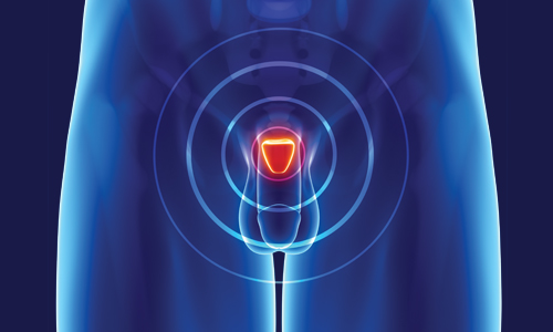 Cirurgia