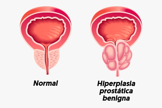 Cirurgia